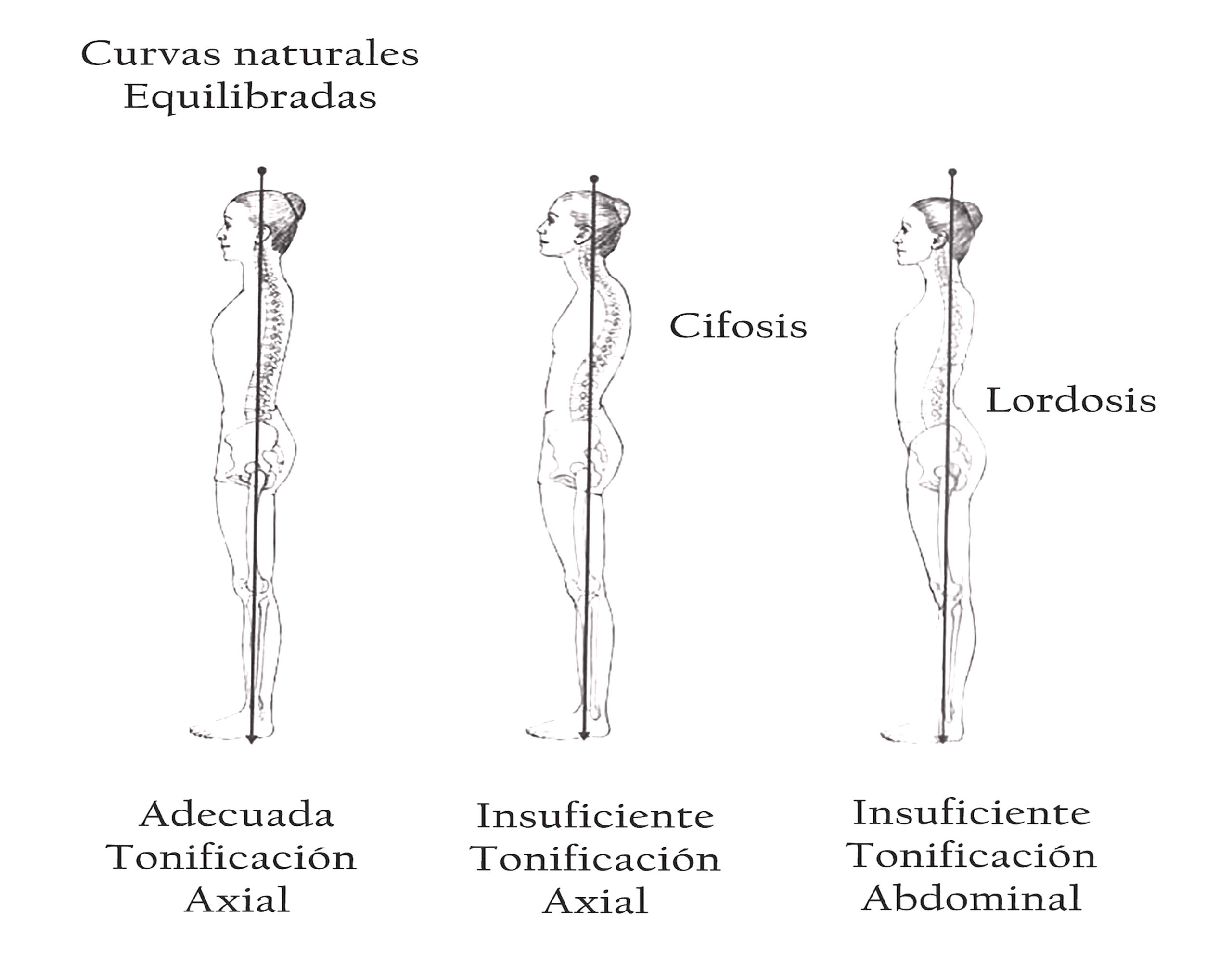 Alineación Pelvica